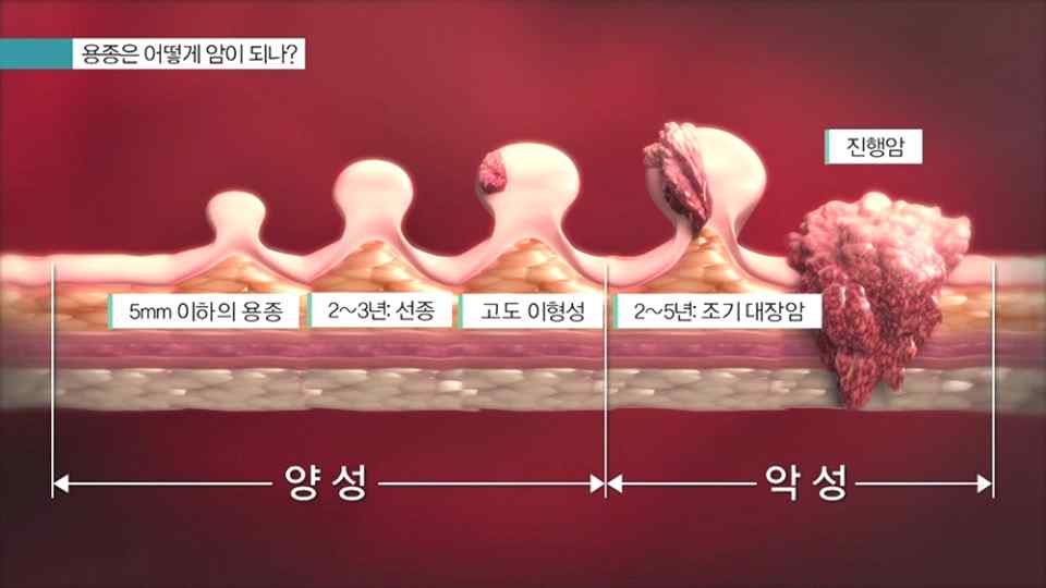 장 정결 안내
